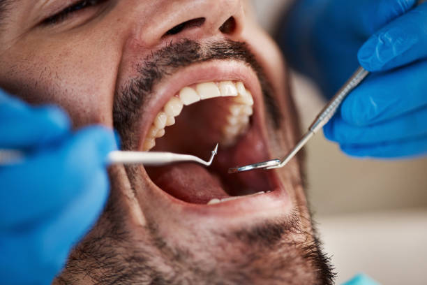 Best Dentist for Tooth Abscess  in Thorndale, TX